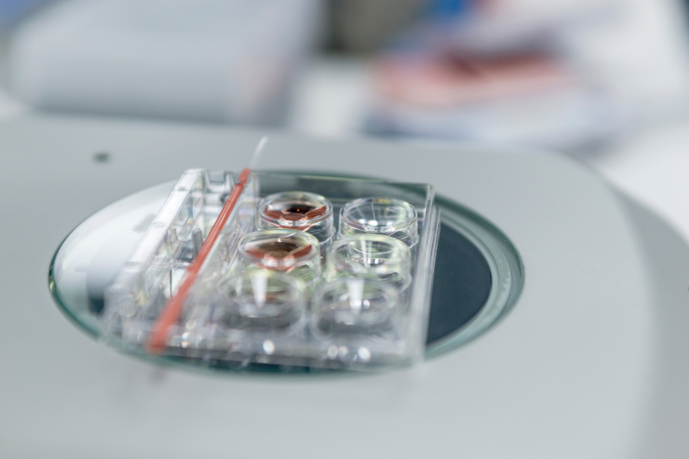 Fertilização in vitro (FIV)